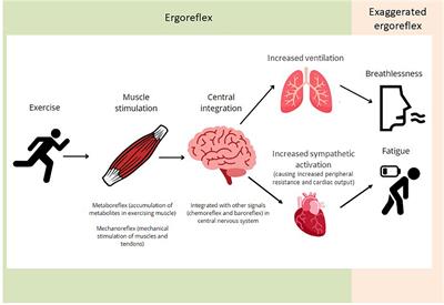 Overstimulation of the ergoreflex—A possible mechanism to explain symptoms in long COVID